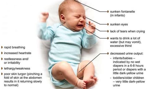 How do I know if my baby is dehydrated
